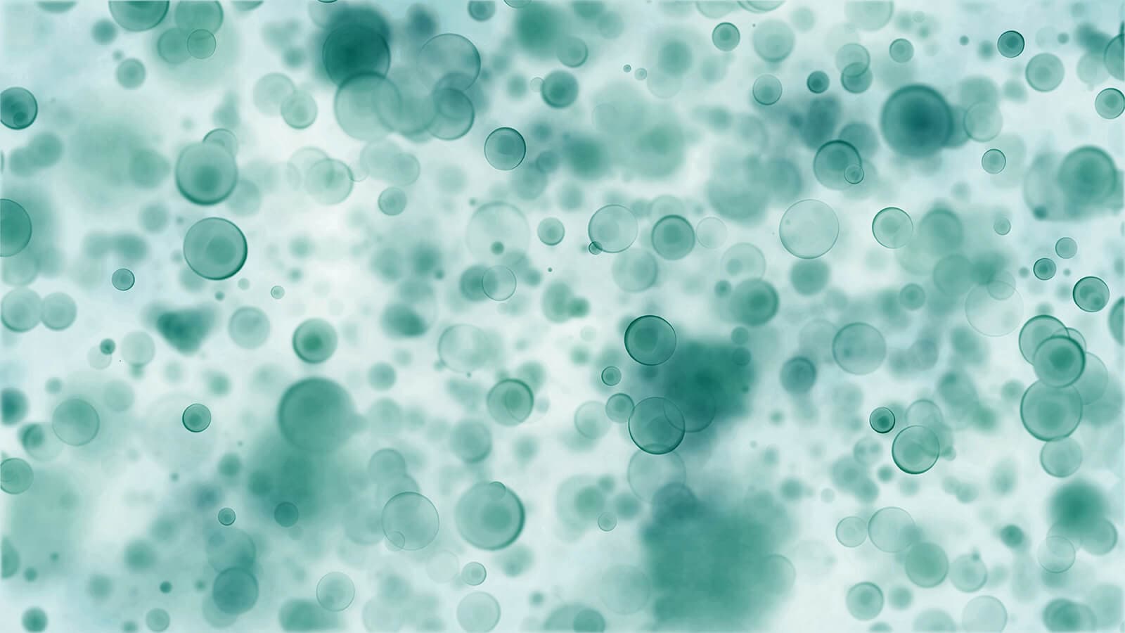 Clonal Evolution of Acute Myeloid Leukemia revealed by high-throughput single-cell genomics